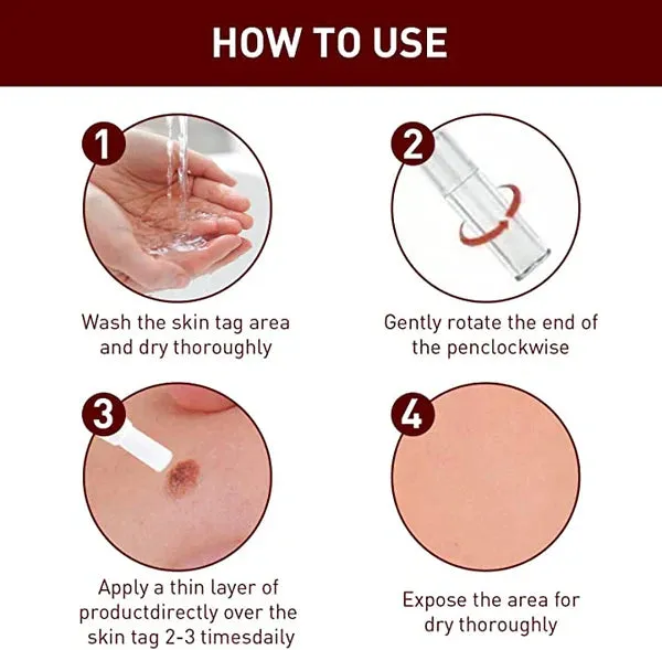Tags & Moles Remover